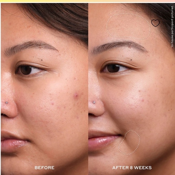 NIB ole henriksen DEWTOPIA 20% ACID NIGHT TREATMENT - Picture 6 of 10